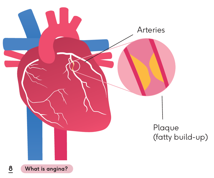 Heart diagram