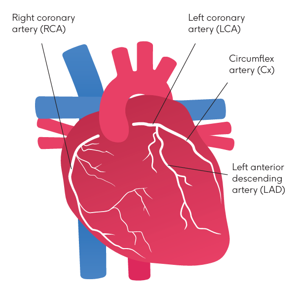 Coronary arteries diagram 