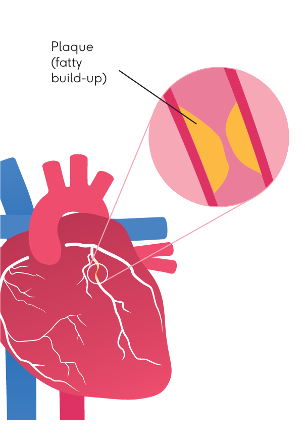 Artery diagram